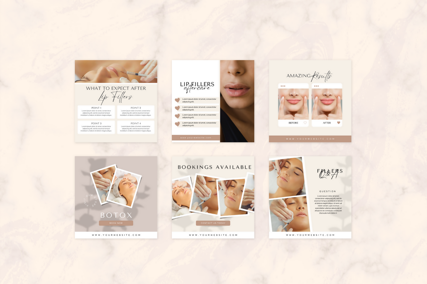 FlawlessFill Canva Botox and Filler Social Media Templates Pack